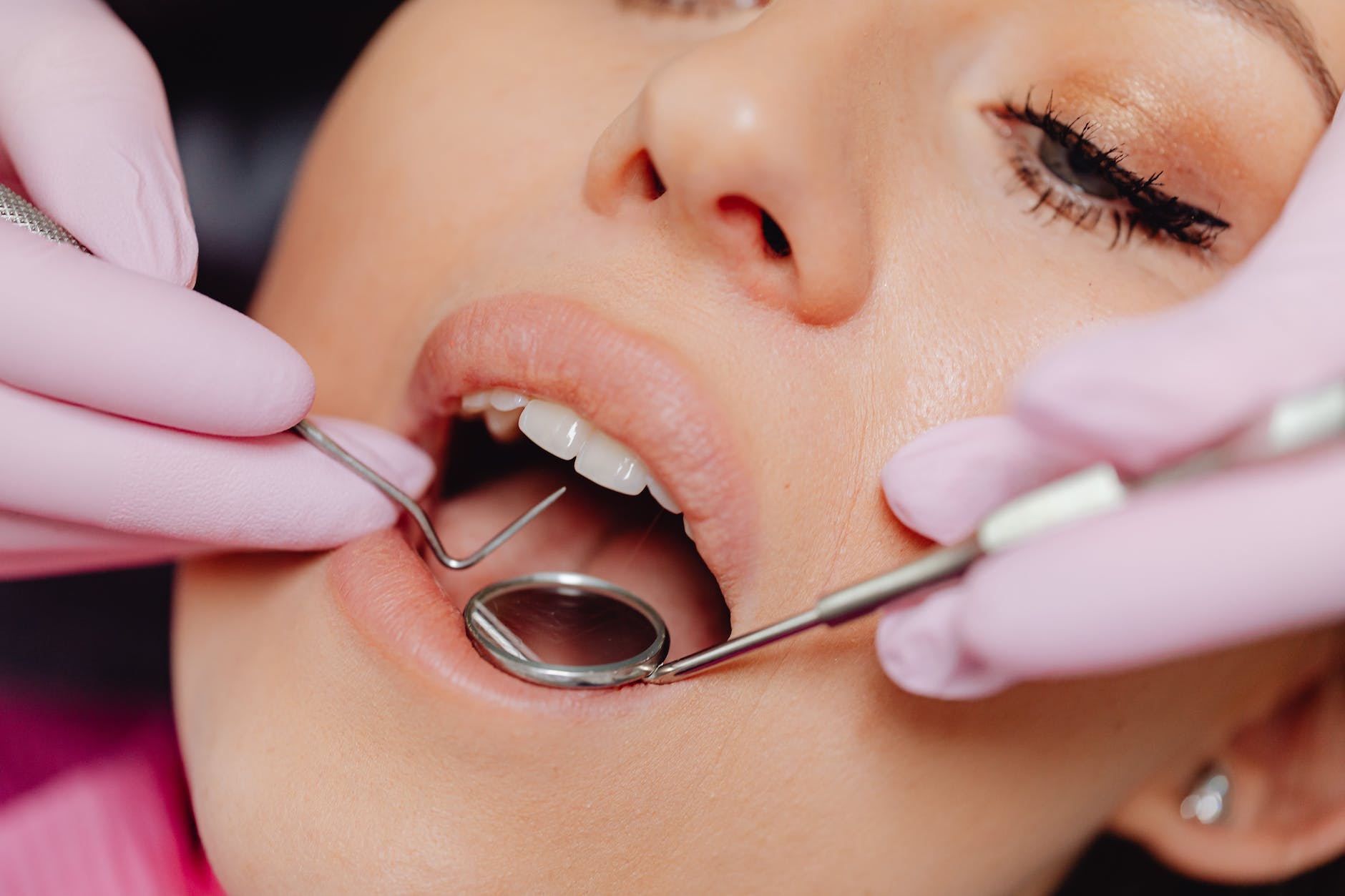 Take Care of Your Teeth: 10 Reasons for a Holistic Dentist